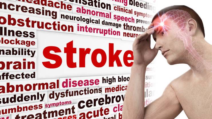 stroke